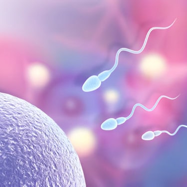 IUI –Intrauterine Insemination or Artificial Insemination (AI)